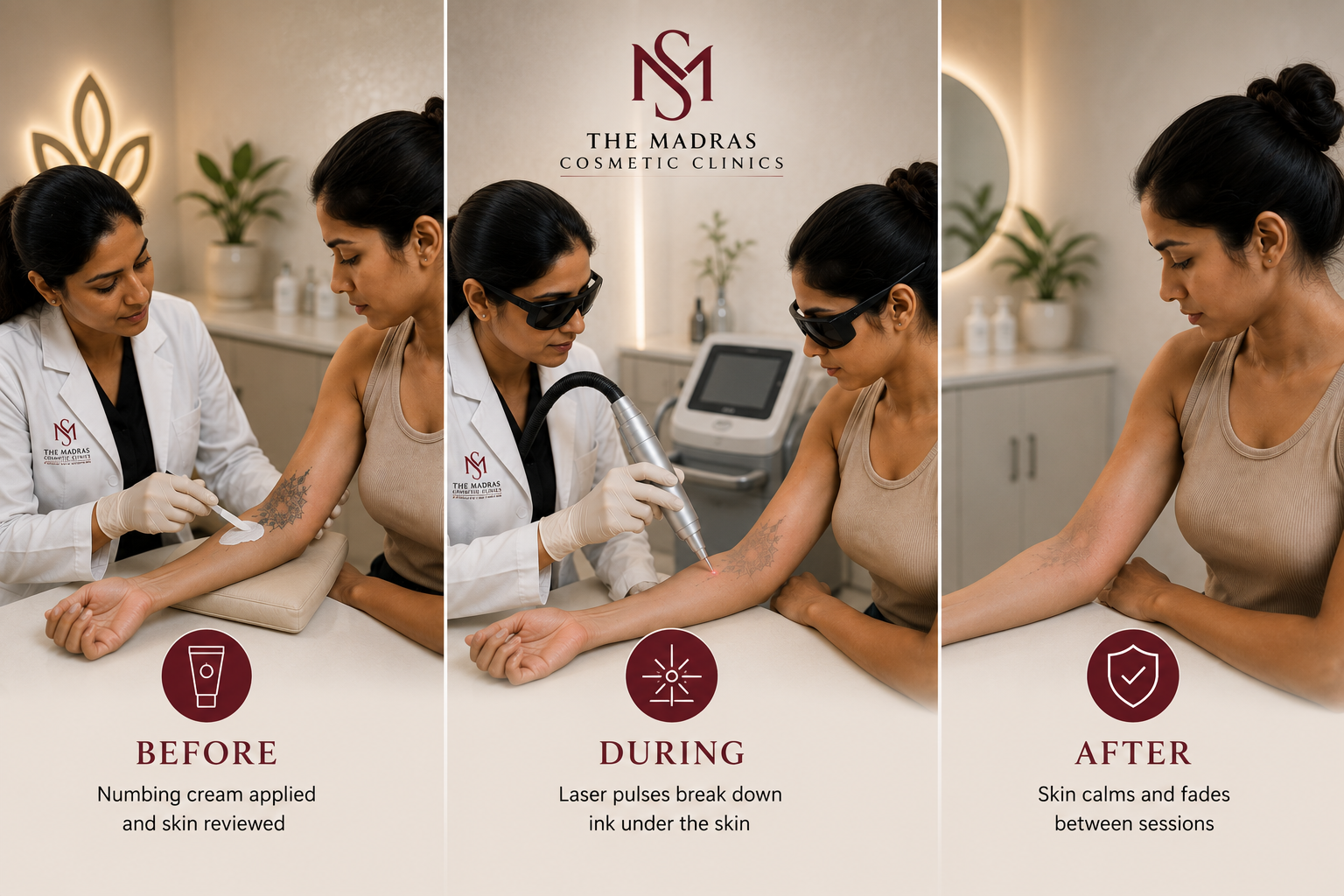 laser treatment for tattoo removal in Omr