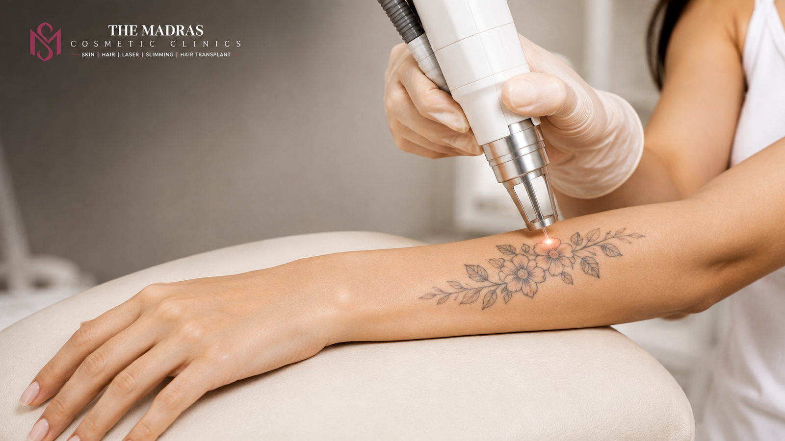 tattoo removal in Omr